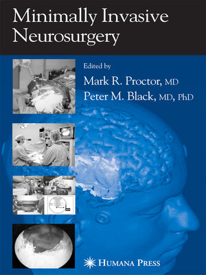 cover image of Minimally Invasive Neurosurgery